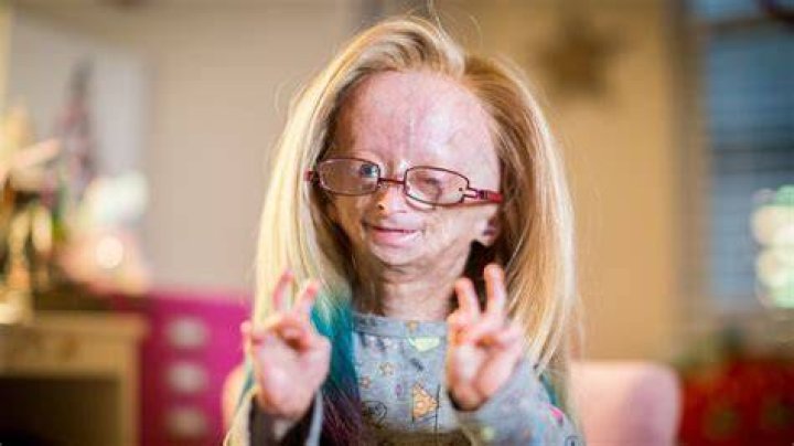 Adalia Rose