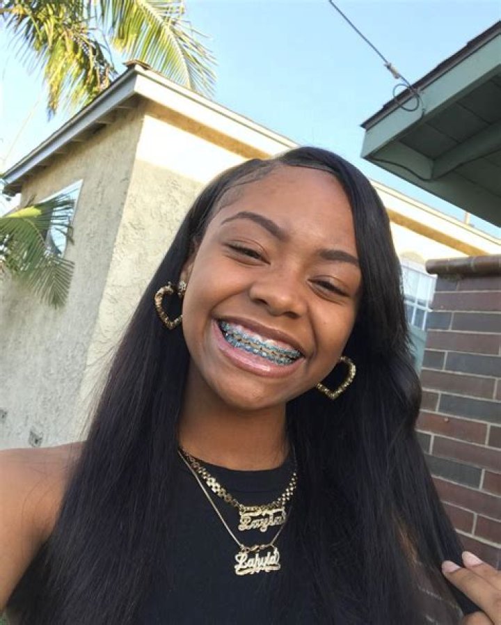 Brace Face Laii