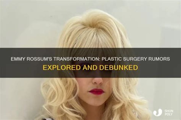 Emmy Rossum Plastic Surgery Before and After