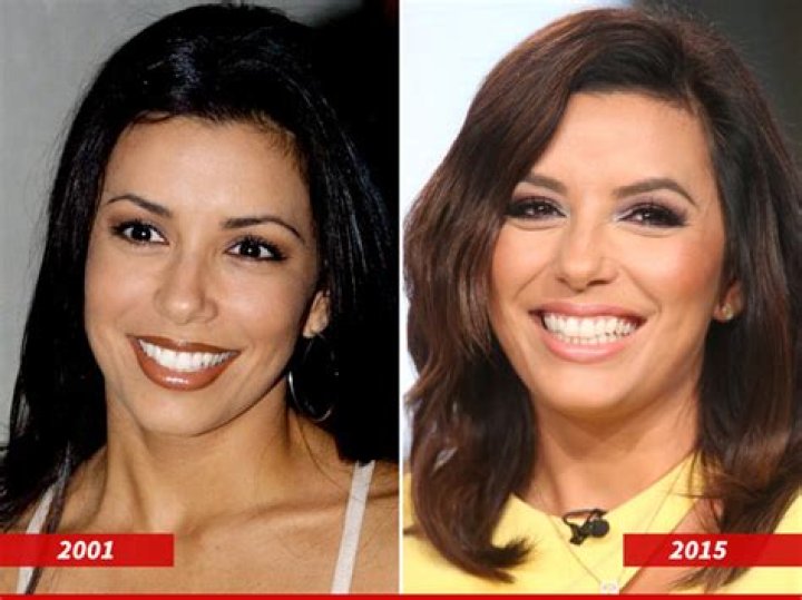Eva Longoria Plastic Surgery Before and After