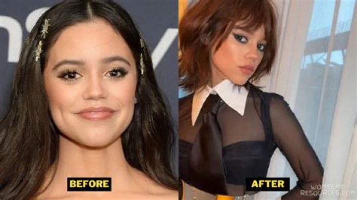 Jenna Ortega Plastic Surgery