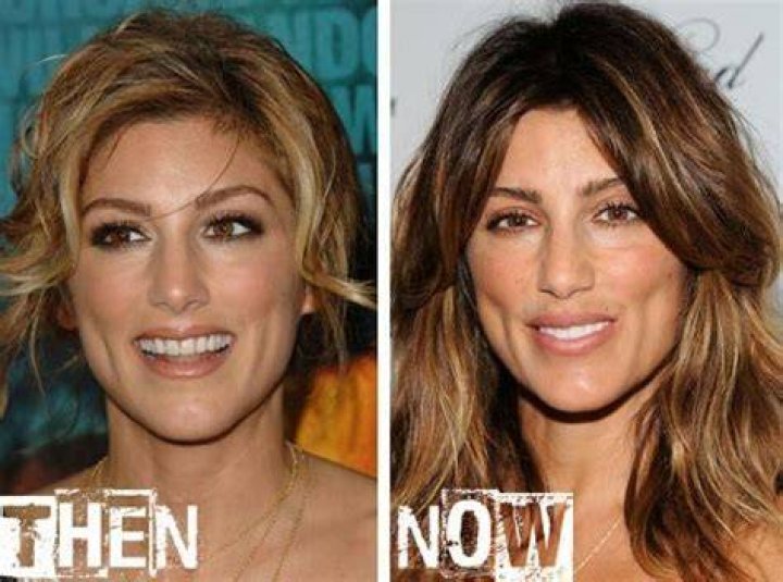 Jennifer Esposito Plastic Surgery Before and After