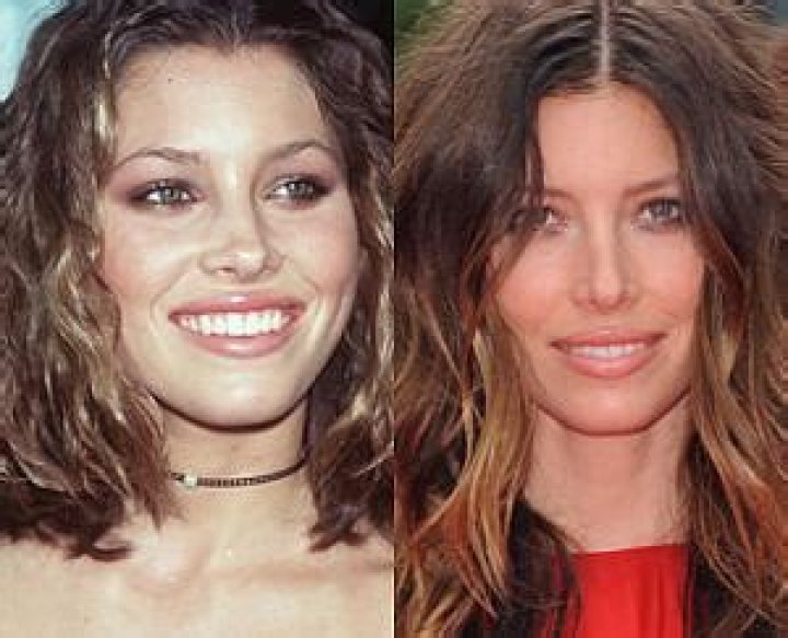 Jessica Biel Plastic Surgery Before and After