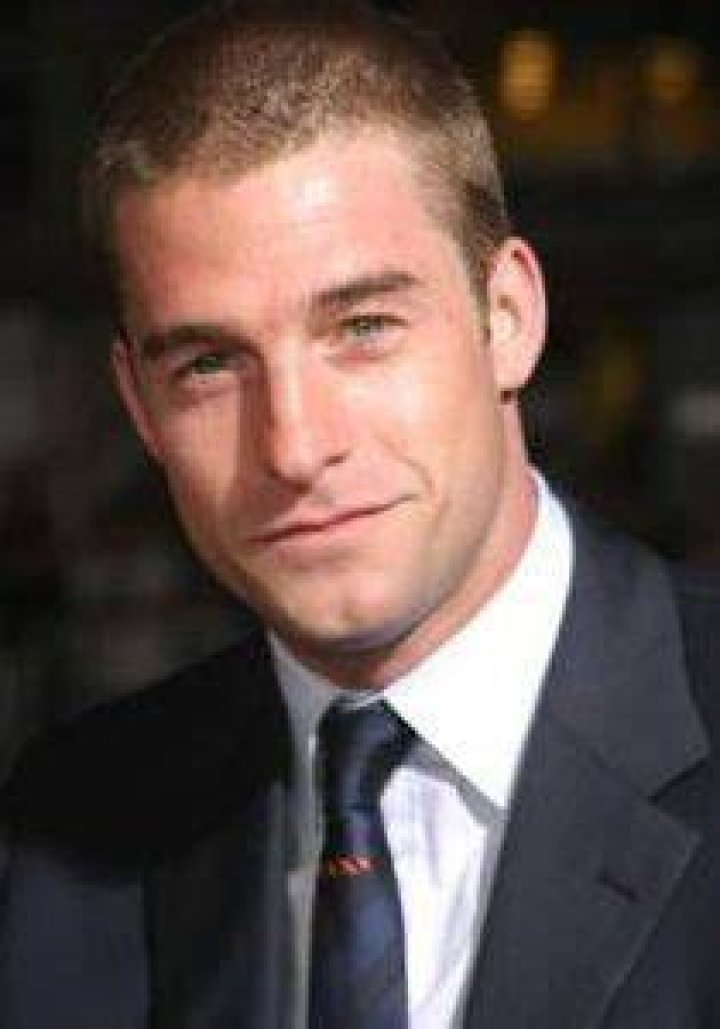 Scott Speedman Plastic Surgery Before and After